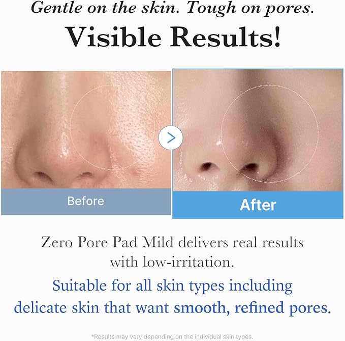 Medicube Zero Pore Pad Mild 2.0 | Say BYE BYE to Pores