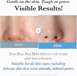 Medicube Zero Pore Pad Mild 2.0 | Say BYE BYE to Pores