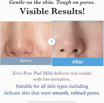 Medicube Zero Pore Pad Mild 2.0 | Say BYE BYE to Pores