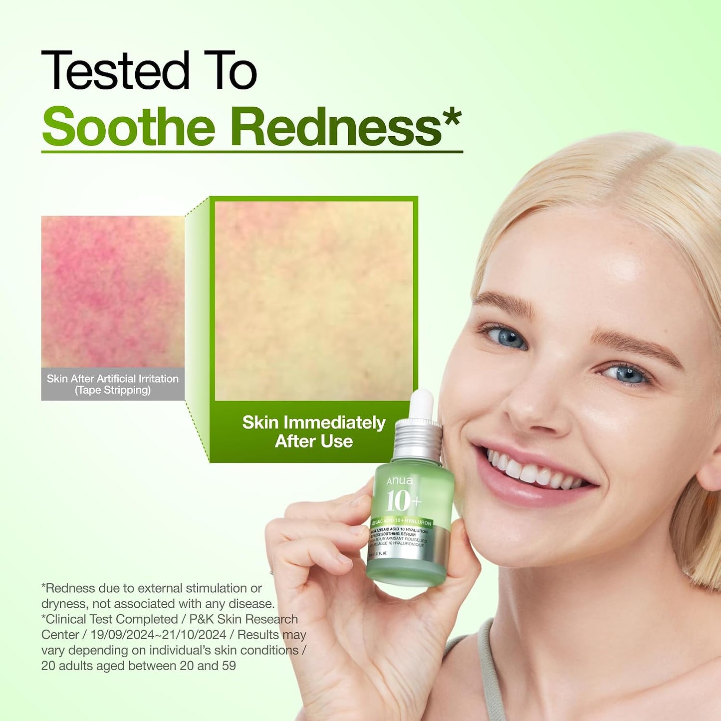 Anua Azelaic Acid 10% Redness Relief Serum – Calm, Clear & Hydrated Skin (30ml)