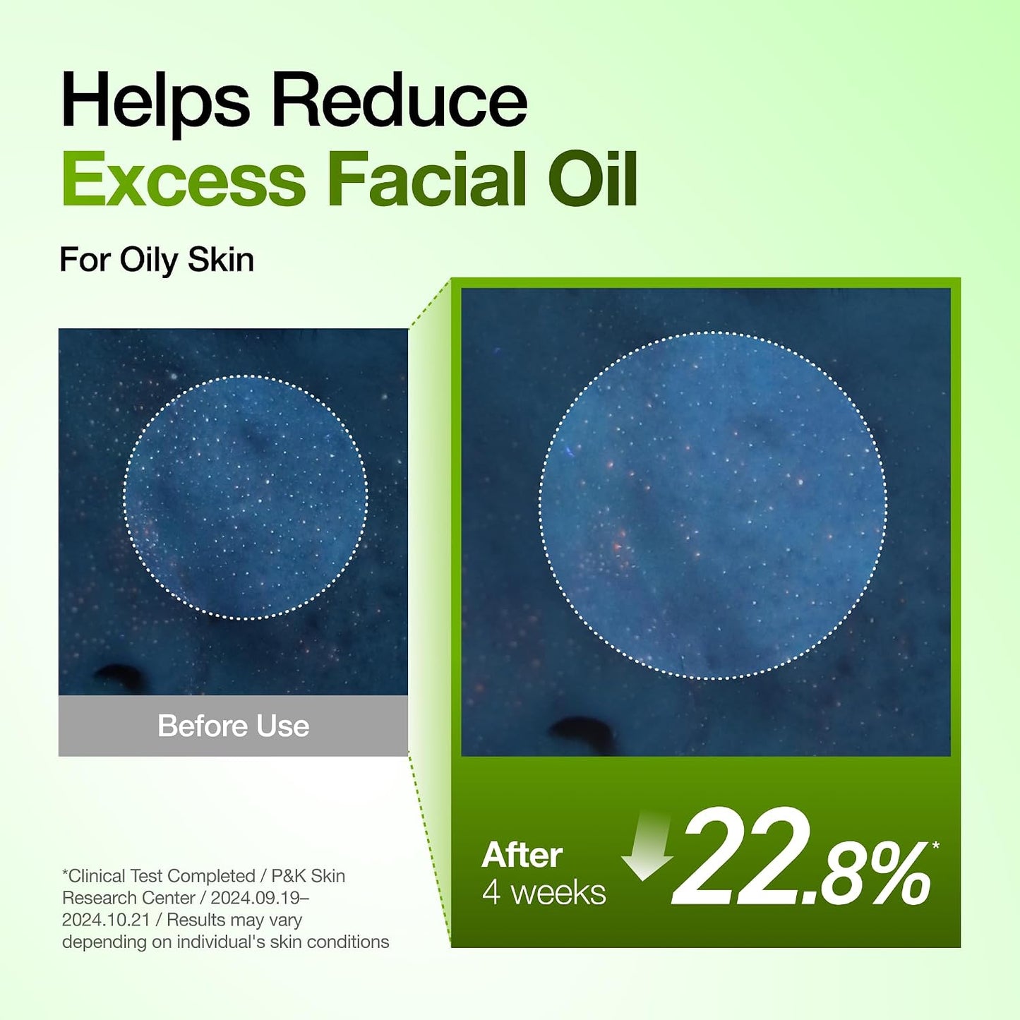 Anua Azelaic Acid 10% Redness Relief Serum – Calm, Clear & Hydrated Skin (30ml)