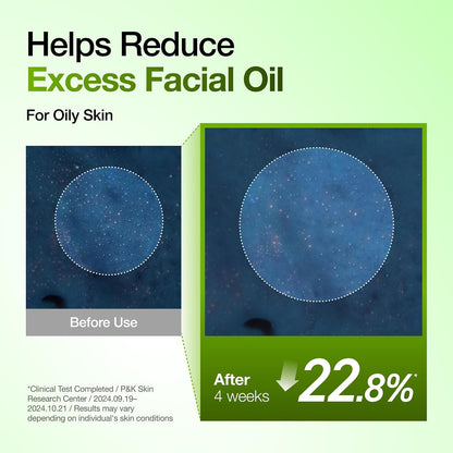 Anua Azelaic Acid 10% Redness Relief Serum – Calm, Clear & Hydrated Skin (30ml)