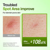 Anua Azelaic Acid 10% Redness Relief Serum – Calm, Clear & Hydrated Skin (30ml)