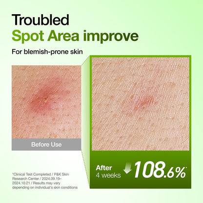 Anua Azelaic Acid 10% Redness Relief Serum – Calm, Clear & Hydrated Skin (30ml)
