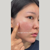 Anua Niacinamide 10% + TXA 4% Serum. Dark Spots Correcting and brightening Serum (30ml)